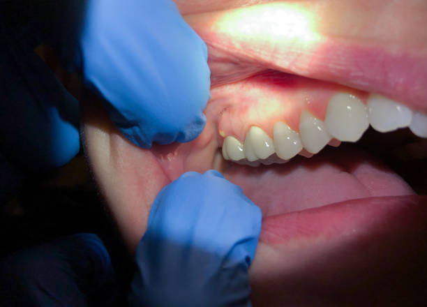 Best Emergency Dental Services Near Me  in Glespie, IL